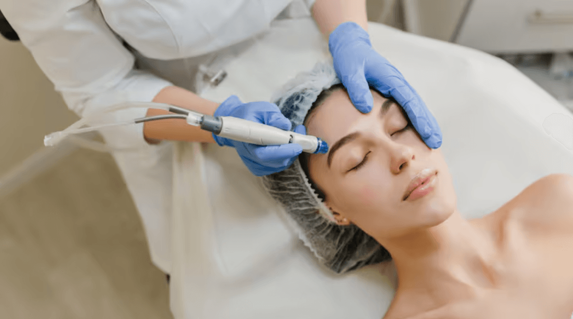 INVIERNO: LA MEJOR ÉPOCA PARA PONER A PUNTO LA PIEL DEL ROSTRO, SEGÚN EXPERTA